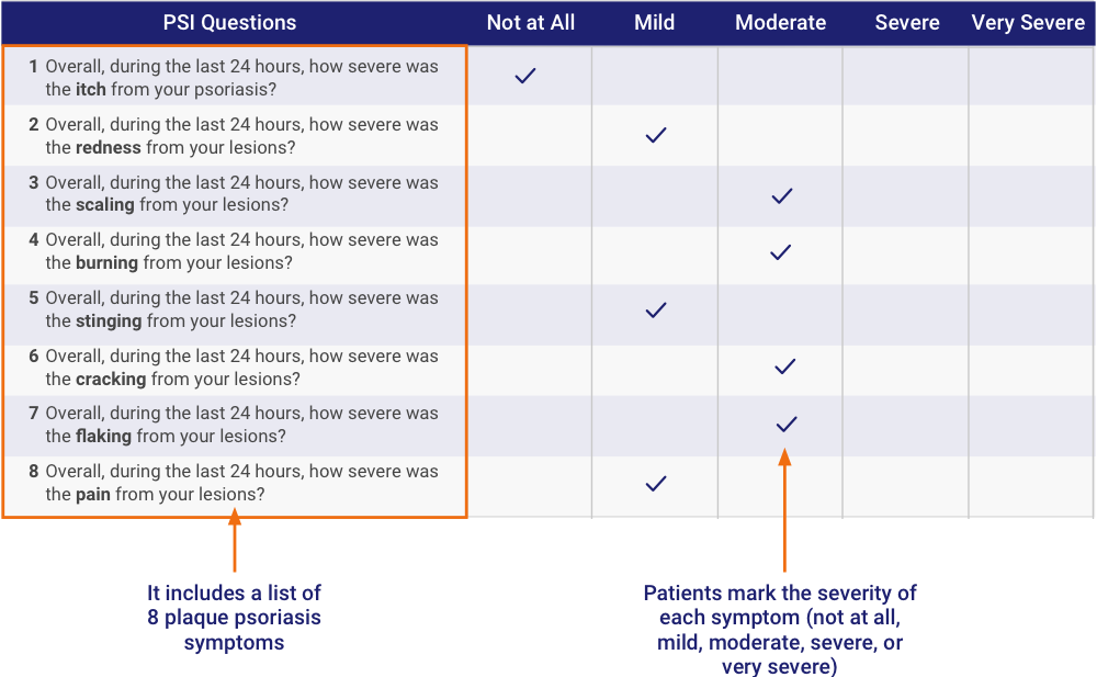 Plaque Psoriasis (PsO) Clinical Trials Enbrel® (etanercept)