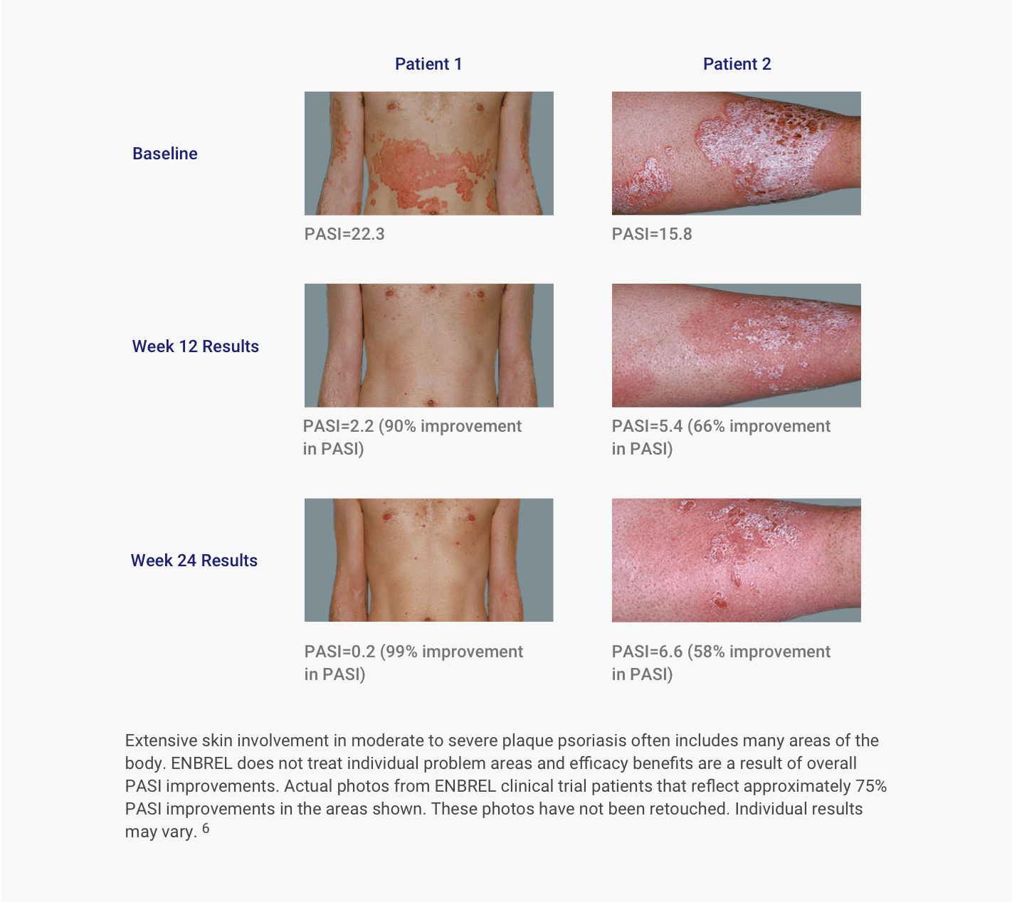 Photos of patients from the Global ENBREL Psoriasis Pivotal Trial